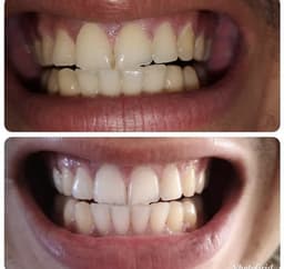 Crema Dental Blanqueadora thumbnail 5
