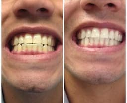 Crema Dental Blanqueadora thumbnail 6