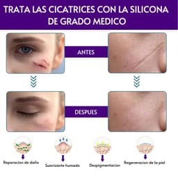 Cinta De Silicona Para Cicatrices thumbnail 3